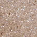 Immunohistochemical staining of human cerebral cortex shows moderate cytoplasmic positivity in neurons.
