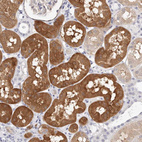 Immunohistochemical staining of human kidney shows moderate cytoplasmic positivity in cells in tubules.
