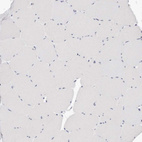 Immunohistochemical staining of human skeletal muscle shows no positivity in myocytes as expected.