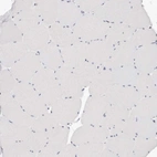 Immunohistochemical staining of human skeletal muscle shows no positivity in myocytes as expected.