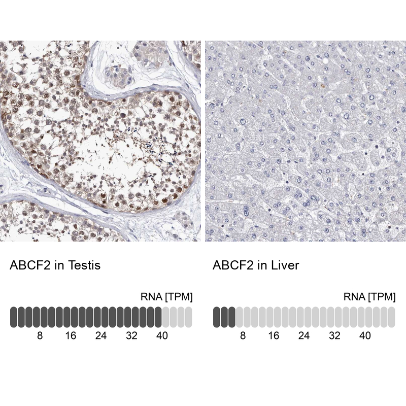 Anti-ABCF2 Antibody