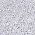 Anti-ABCF2 Antibody