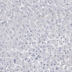 Immunohistochemical staining of human liver shows low expression as expected.