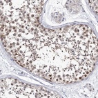 Anti-ABCF2 Antibody