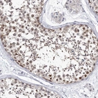 Immunohistochemical staining of human testis shows high expression.