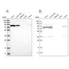Western blot analysis using Anti-ABCF2 antibody HPA030388 (A) shows similar pattern to independent antibody HPA020091 (B).