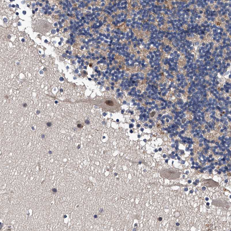 Anti-ZNF30 Antibody