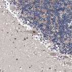Anti-ZNF30 Antibody