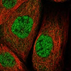 Immunofluorescent staining of human cell line A-431 shows localization to nucleoplasm & cytosol.