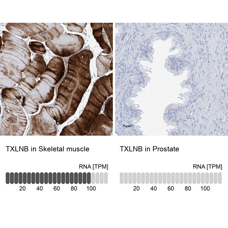 Anti-TXLNB Antibody