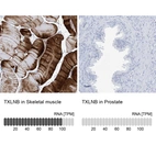 Anti-TXLNB Antibody