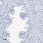 Immunohistochemical staining of human prostate shows low expression as expected.