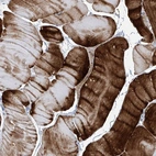 Immunohistochemical staining of human skeletal muscle shows high expression.