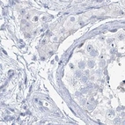 Immunohistochemical staining of human testis using Anti-TXLNB antibody HPA030401.