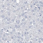 Immunohistochemical staining of human liver using Anti-TXLNB antibody HPA030401.