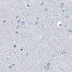 Immunohistochemical staining of human cerebral cortex using Anti-TXLNB antibody HPA030401.