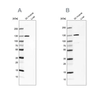 Western blot analysis using Anti-TXLNB antibody HPA030401 (A) shows similar pattern to independent antibody HPA030403 (B).
