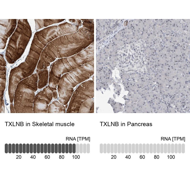 Anti-TXLNB Antibody