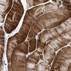Immunohistochemical staining of human skeletal muscle shows high expression.