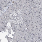 Immunohistochemical staining of human pancreas shows low expression as expected.