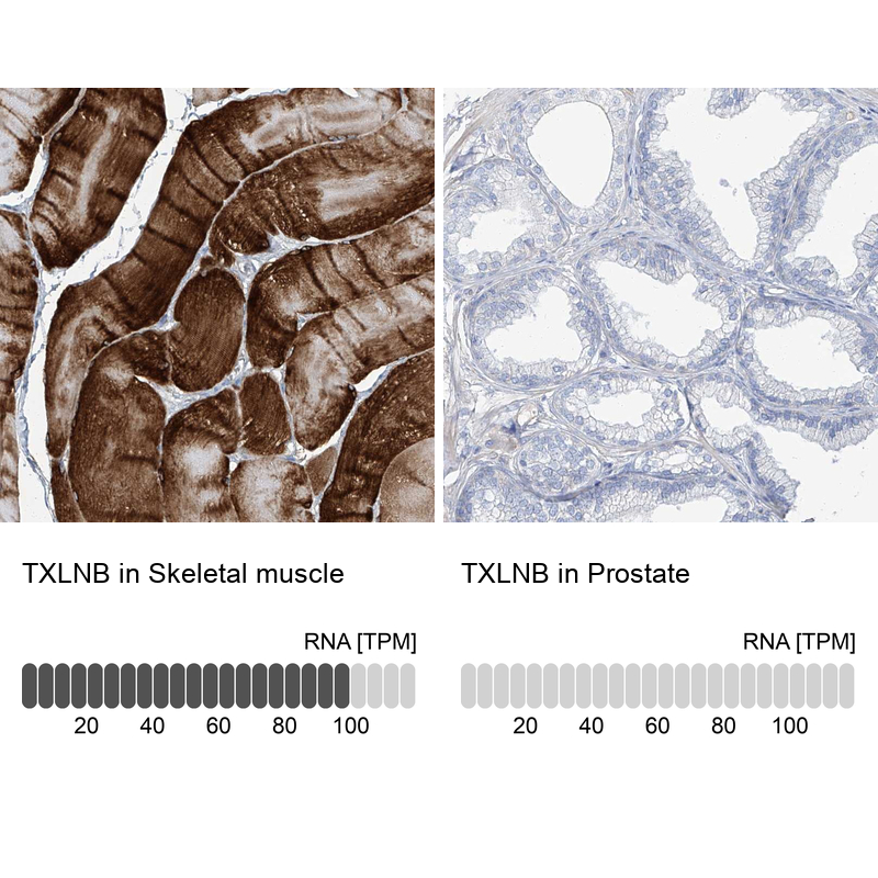 Anti-TXLNB Antibody