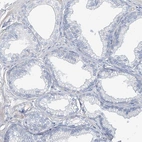 Immunohistochemical staining of human prostate shows low expression as expected.