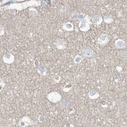 Immunohistochemical staining of human cerebral cortex using Anti-TXLNB antibody HPA030403.