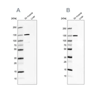 Western blot analysis using Anti-TXLNB antibody HPA030403 (A) shows similar pattern to independent antibody HPA030401 (B).