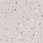 Anti-TSC2 Antibody