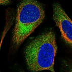 Immunofluorescent staining of human cell line U-2 OS shows localization to cytosol.
