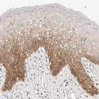 Immunohistochemical staining of human skin shows strong membranous positivity in squamous epithelial cells.