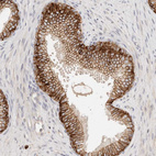 Immunohistochemical staining of human prostate shows strong membranous positivity in glandular cells.