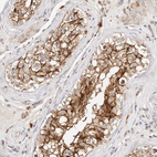 Immunohistochemical staining of human testis shows strong membranous positivity in cells in seminiferous ducts.