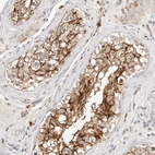 Immunohistochemical staining of human testis shows strong membranous positivity in cells in seminiferous ducts.