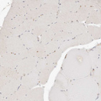 Immunohistochemical staining of human skeletal muscle shows no positivity in myocytes as expected.