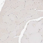 Immunohistochemical staining of human skeletal muscle shows no positivity in myocytes as expected.