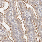 Anti-CXADR Antibody