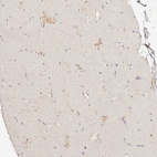 Immunohistochemical staining of human skeletal muscle shows low positivity in myocytes as expected.