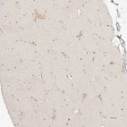 Immunohistochemical staining of human skeletal muscle shows low positivity in myocytes as expected.