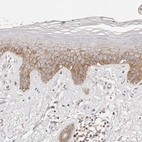 Immunohistochemical staining of human skin shows moderate membranous positivity in squamous epithelial cells.