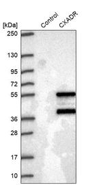 Western blot analysis in control (vector only transfected HEK293T lysate) and CXADR over-expression lysate (Co-expressed with a C-terminal myc-DDK tag (~3.1 kDa) in mammalian HEK293T cells, LY419998).