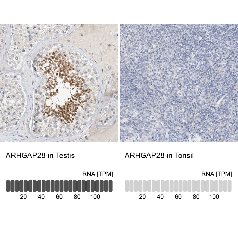 Anti-ARHGAP28 Antibody