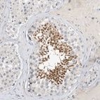 Immunohistochemical staining of human testis shows strong cytoplasmic positivity in cells in seminiferous ducts.