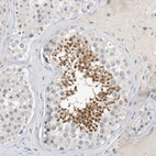 Immunohistochemical staining of human testis shows strong cytoplasmic positivity in cells in seminiferous ducts.