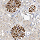 Immunohistochemical staining of human kidney shows strong cytoplasmic positivity in cells in glomeruli.