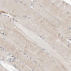 Immunohistochemical staining of human skeletal muscle shows weak cytoplasmic positivity in myocytes.