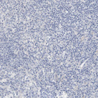 Immunohistochemical staining of human tonsil shows no positivity in non-germinal center cells as expected.