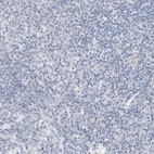 Immunohistochemical staining of human tonsil shows no positivity in non-germinal center cells as expected.