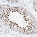 Anti-ARHGAP28 Antibody