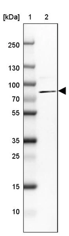 Lane 1: Marker [kDa] 250, 130, 100, 70, 55, 35, 25, 15, 10_br/_Lane 2: Human cell line CACO-2